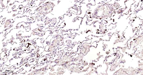 Human Ferritin Heavy Chain Ready-To-Use IHC Kit (免疫组化试剂盒) - IHC-P | Bioss